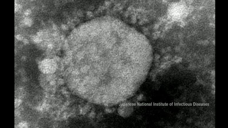 Tokyo confirms 327 new cases of coronavirus