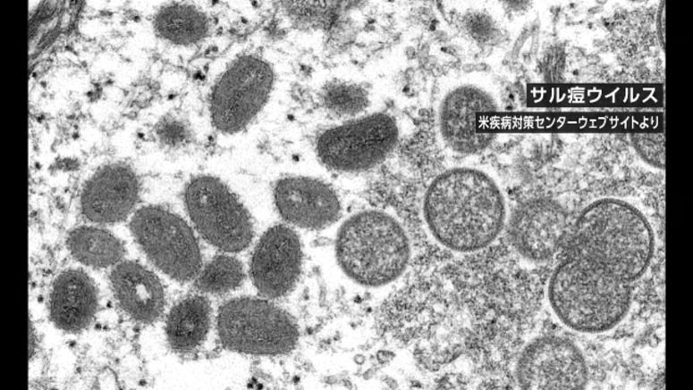 Health ministry: No monkeypox identified in Japan so far