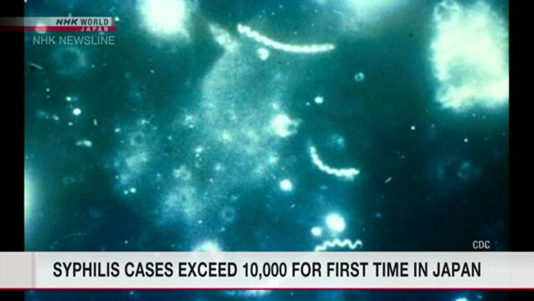 Japan records over 10,000 syphilis cases for first time