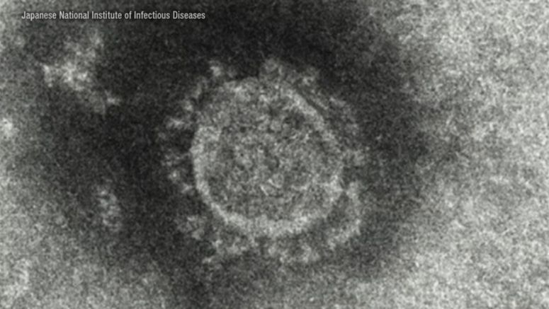 Coronavirus infections in Japan top 8,100