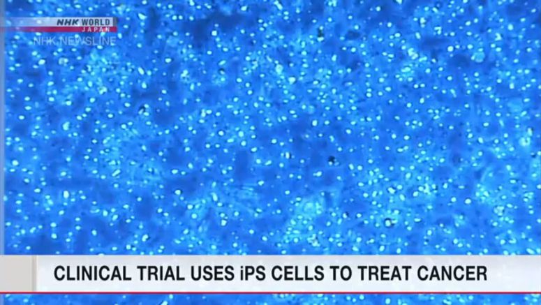 Clinical test uses iPS cells to treat cancer
