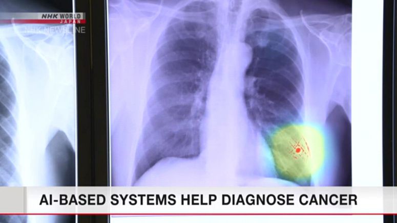 AI-based systems help diagnose cancer